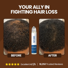 Patented Rosemary Hair Growth Roll-On Serum